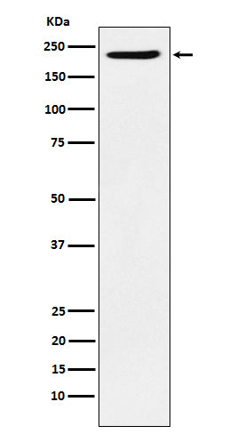 Anti-PBRM1 Rabbit Monoclonal Antibody Boster Bio