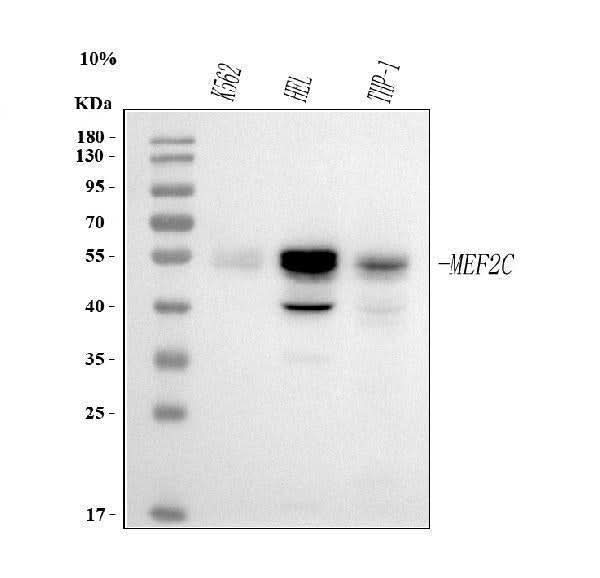 Anti-MEF2A+MEF2C Rabbit Monoclonal Antibody Boster Bio