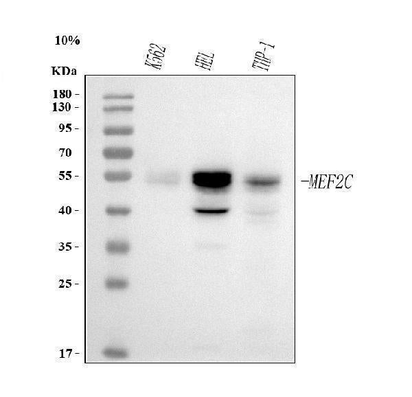Anti-MEF2A+MEF2C Rabbit Monoclonal Antibody Boster Bio