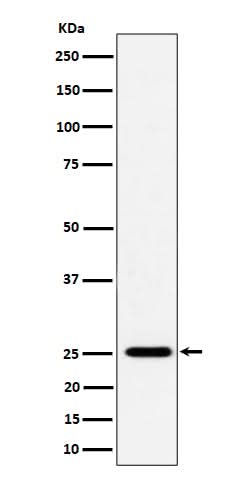 Anti-CFD Rabbit Monoclonal Antibody Boster Bio
