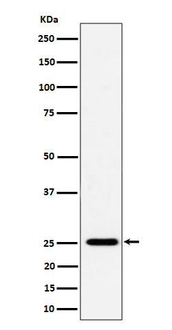 Anti-CFD Rabbit Monoclonal Antibody Boster Bio