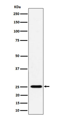 Anti-CFD Rabbit Monoclonal Antibody Boster Bio