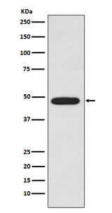 Anti-Galactosidase alpha Rabbit Monoclonal Antibody Boster Bio