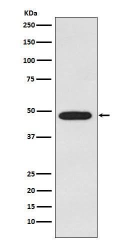 Anti-Galactosidase alpha Rabbit Monoclonal Antibody Boster Bio