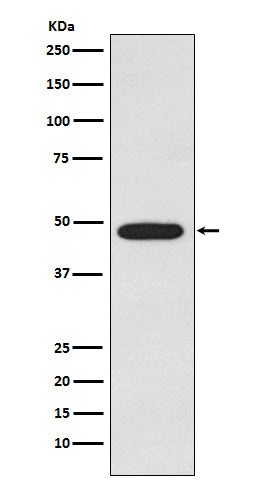Anti-Galactosidase alpha Rabbit Monoclonal Antibody Boster Bio