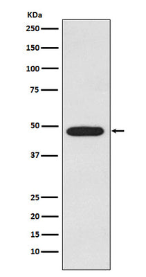 Anti-Galactosidase alpha Rabbit Monoclonal Antibody Boster Bio
