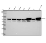 Anti-P2Y12 Rabbit Monoclonal Antibody Boster Bio
