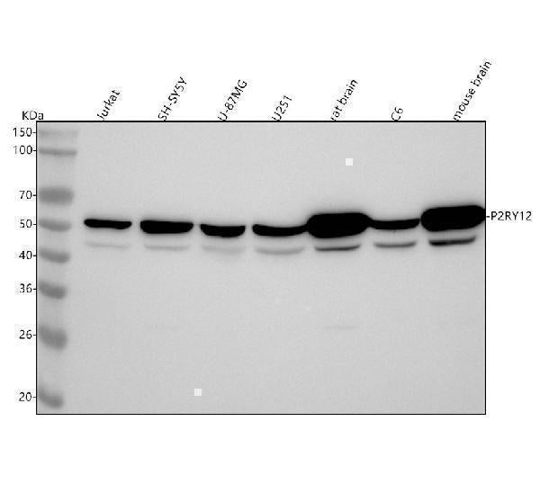 Anti-P2Y12 Rabbit Monoclonal Antibody Boster Bio