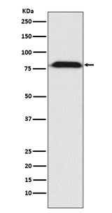 Anti-MAD1 Rabbit Monoclonal Antibody Boster Bio
