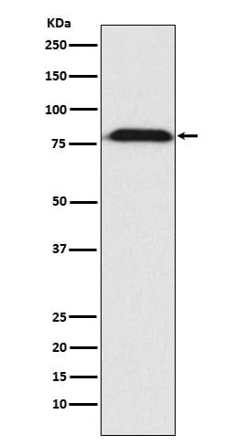 Anti-MAD1 Rabbit Monoclonal Antibody Boster Bio