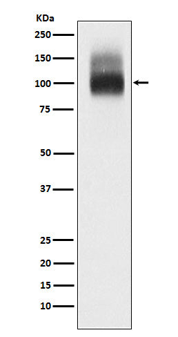 Anti-SLC4A1/CD233/Band 3 Rabbit Monoclonal Antibody Boster Bio