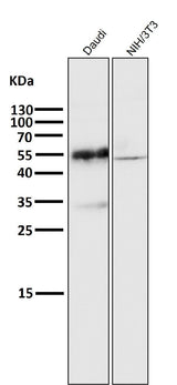 Anti-CD27 Rabbit Monoclonal Antibody Boster Bio