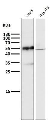 Anti-CD27 Rabbit Monoclonal Antibody Boster Bio