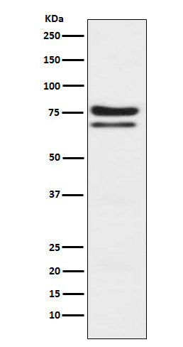 Anti-PKC epsilon Monoclonal Antibody Boster Bio