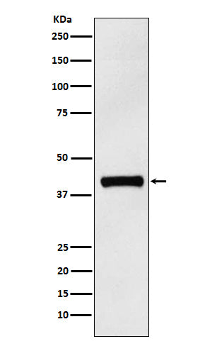 Anti-IL12 p40 Rabbit Monoclonal Antibody Boster Bio