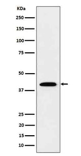 Anti-IL12B Rabbit Monoclonal Antibody Boster Bio