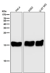 Anti-PBR TSPO Rabbit Monoclonal Antibody Boster Bio