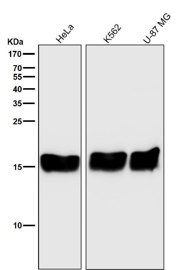 Anti-PBR TSPO Rabbit Monoclonal Antibody Boster Bio
