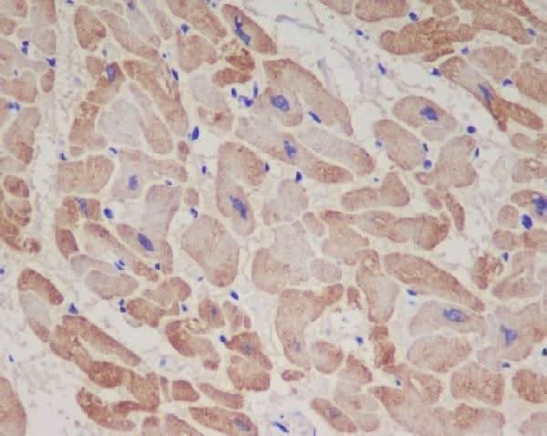 Anti-Troponin T TNNT2 Rabbit Monoclonal Antibody Boster Bio