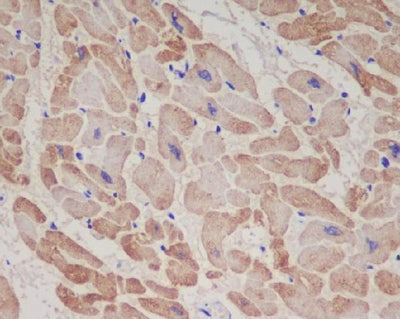 Anti-Troponin T TNNT2 Rabbit Monoclonal Antibody Boster Bio