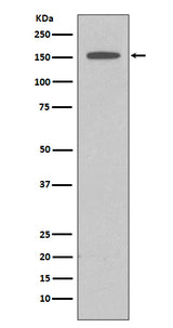 Anti-DAP Kinase 1 DAPK1 Rabbit Monoclonal Antibody Boster Bio