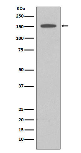 Anti-DAP Kinase 1 DAPK1 Rabbit Monoclonal Antibody Boster Bio