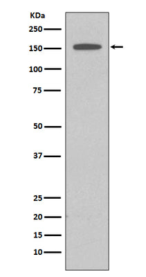 Anti-DAP Kinase 1 DAPK1 Rabbit Monoclonal Antibody Boster Bio