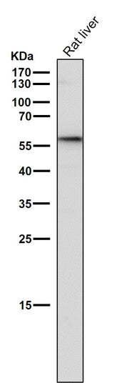 Anti-GBA/Glucosylceramidase Rabbit Monoclonal Antibody Boster Bio