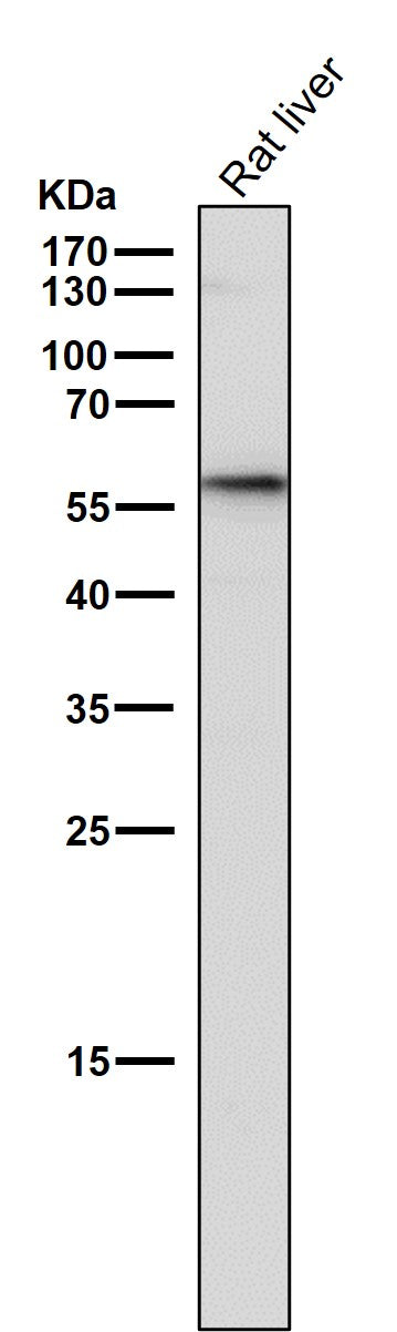 Anti-GBA/Glucosylceramidase Rabbit Monoclonal Antibody Boster Bio