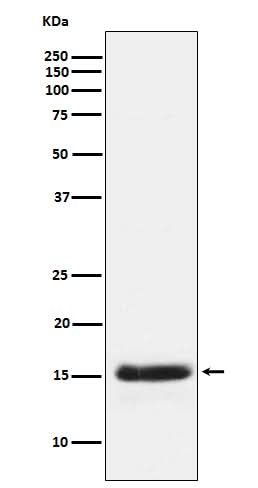 Anti-PLGF Rabbit Monoclonal Antibody Boster Bio
