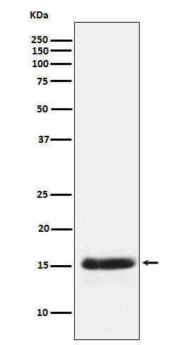 Anti-PLGF Rabbit Monoclonal Antibody Boster Bio