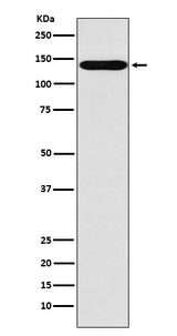 Anti-SLC9A1 Rabbit Monoclonal Antibody Boster Bio
