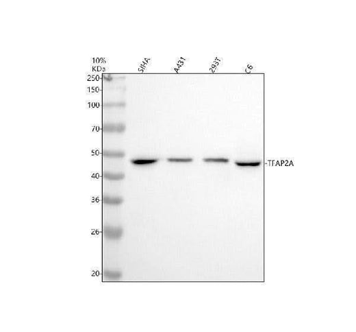 Anti-AP2 alpha Rabbit Monoclonal Antibody Boster Bio