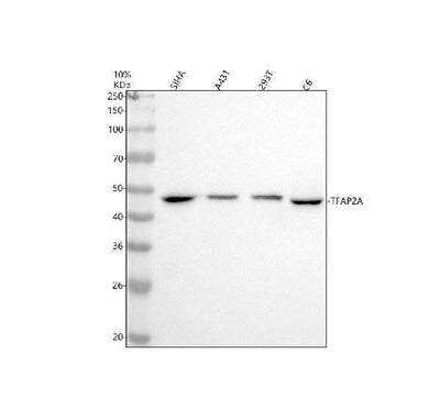 Anti-AP2 alpha Rabbit Monoclonal Antibody Boster Bio