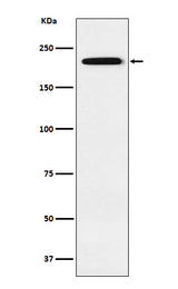 Anti-Gli3 Rabbit Monoclonal Antibody Boster Bio