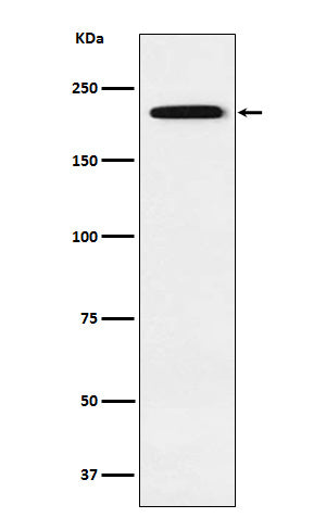 Anti-Gli3 Rabbit Monoclonal Antibody Boster Bio