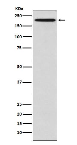Anti-GCN2 EIF2AK4 Rabbit Monoclonal Antibody Boster Bio