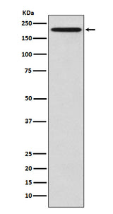 Anti-GCN2 EIF2AK4 Rabbit Monoclonal Antibody Boster Bio