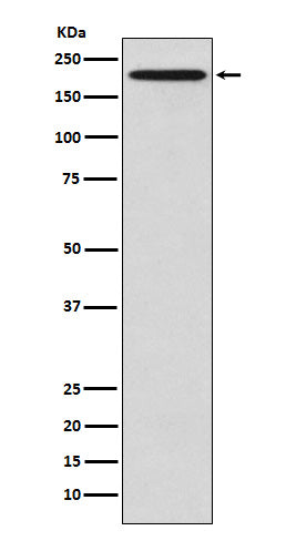 Anti-GCN2 EIF2AK4 Rabbit Monoclonal Antibody Boster Bio
