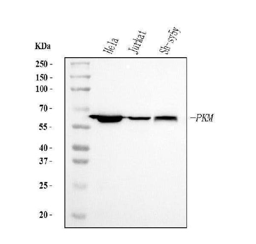 Anti-PKM2 Antibody Picoband® (monoclonal, 11I4C3 Boster Bio
