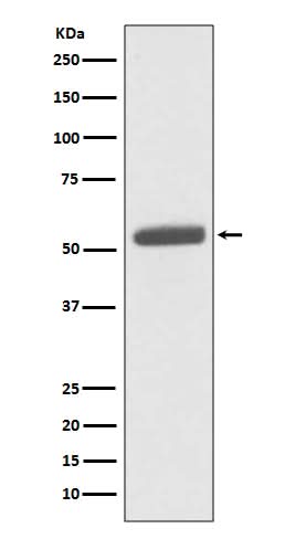 Anti-PKM2 Rabbit Monoclonal Antibody Boster Bio