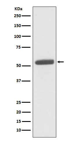 Anti-PKM2 Rabbit Monoclonal Antibody Boster Bio
