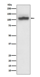 Anti-SERCA2 ATP2A2 Rabbit Monoclonal Antibody Boster Bio