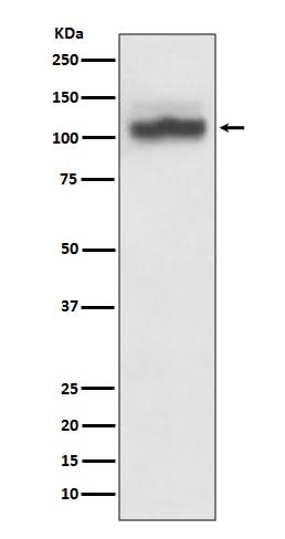 Anti-SERCA2 ATP2A2 Rabbit Monoclonal Antibody Boster Bio