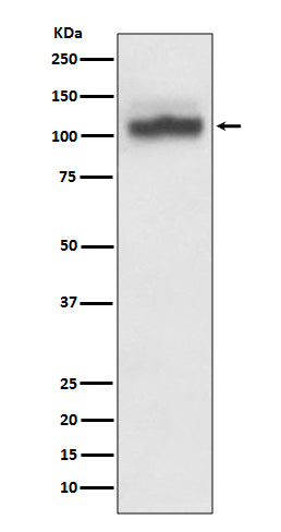 Anti-SERCA2 ATP2A2 Rabbit Monoclonal Antibody Boster Bio