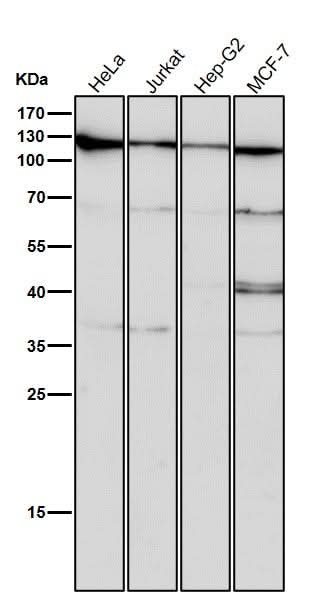 Anti-CRM1 Rabbit Monoclonal Antibody Boster Bio