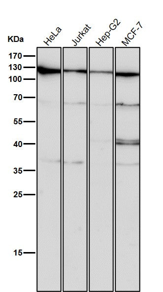 Anti-CRM1 Rabbit Monoclonal Antibody Boster Bio