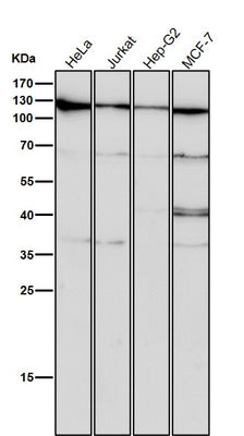 Anti-CRM1 Rabbit Monoclonal Antibody Boster Bio