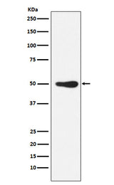 Anti-FOXL2 Rabbit Monoclonal Antibody Boster Bio