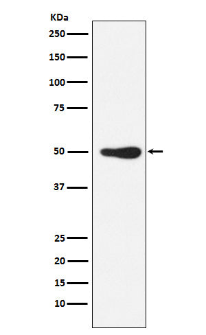 Anti-FOXL2 Rabbit Monoclonal Antibody Boster Bio